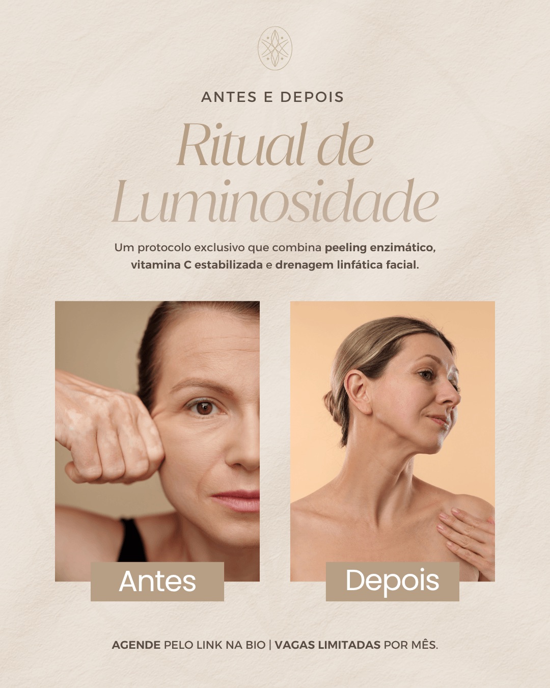 Antes-e-depois-tratamento-clinica-de-estetica-dourado-post-do-instagram.jpeg